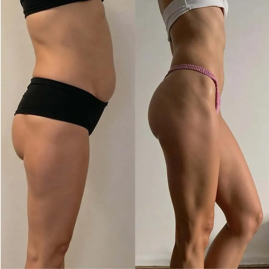 Resultado 05: transformação física antes e depois